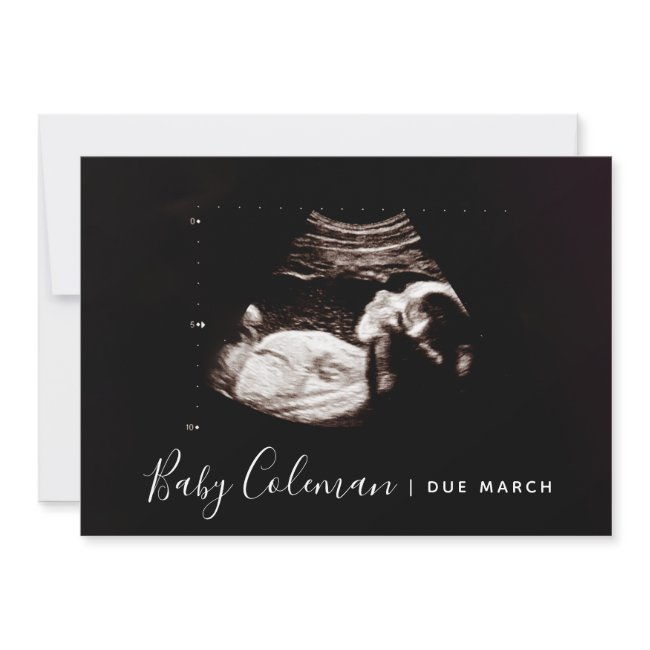 Pregnancy Announcement Sonogram Script Name Card