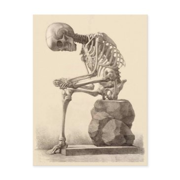 my feet are killing me postinvitations